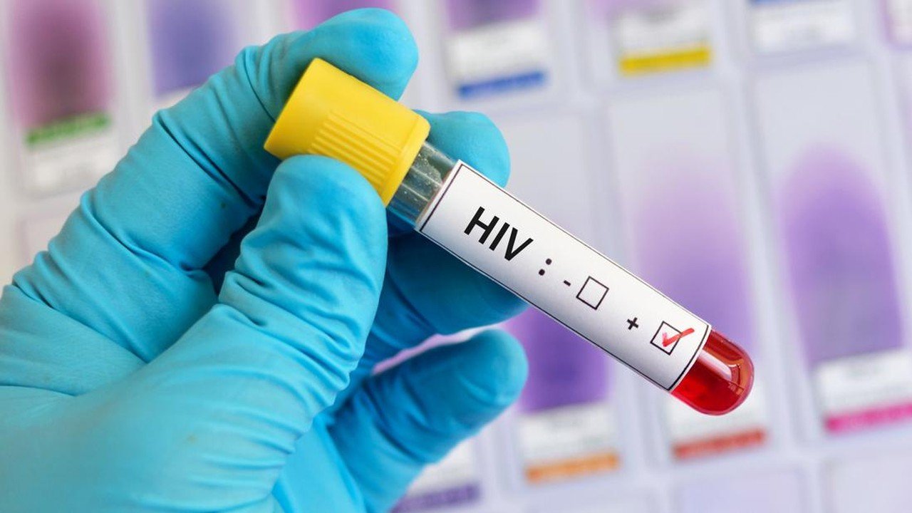 Dua Pemeran Video Mesum 'A Day in My Life' di Bogor Terkonfirmasi Mengidap HIV